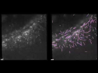 instantaneous fluorescence polarization microscope orientation of actin filaments - medium [mp4]