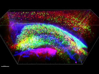 3-d analysis of intact mouse hippocampus